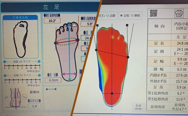 足の状態を数値化する検査機器